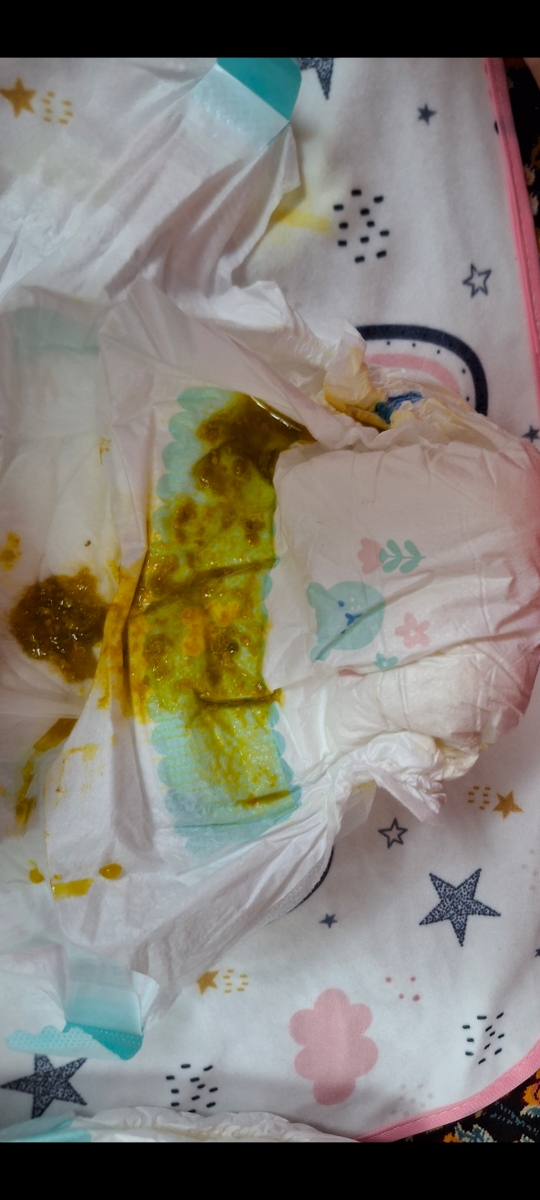 این مدفوع طبيعي یانه این مدفوع طبيعي یانه