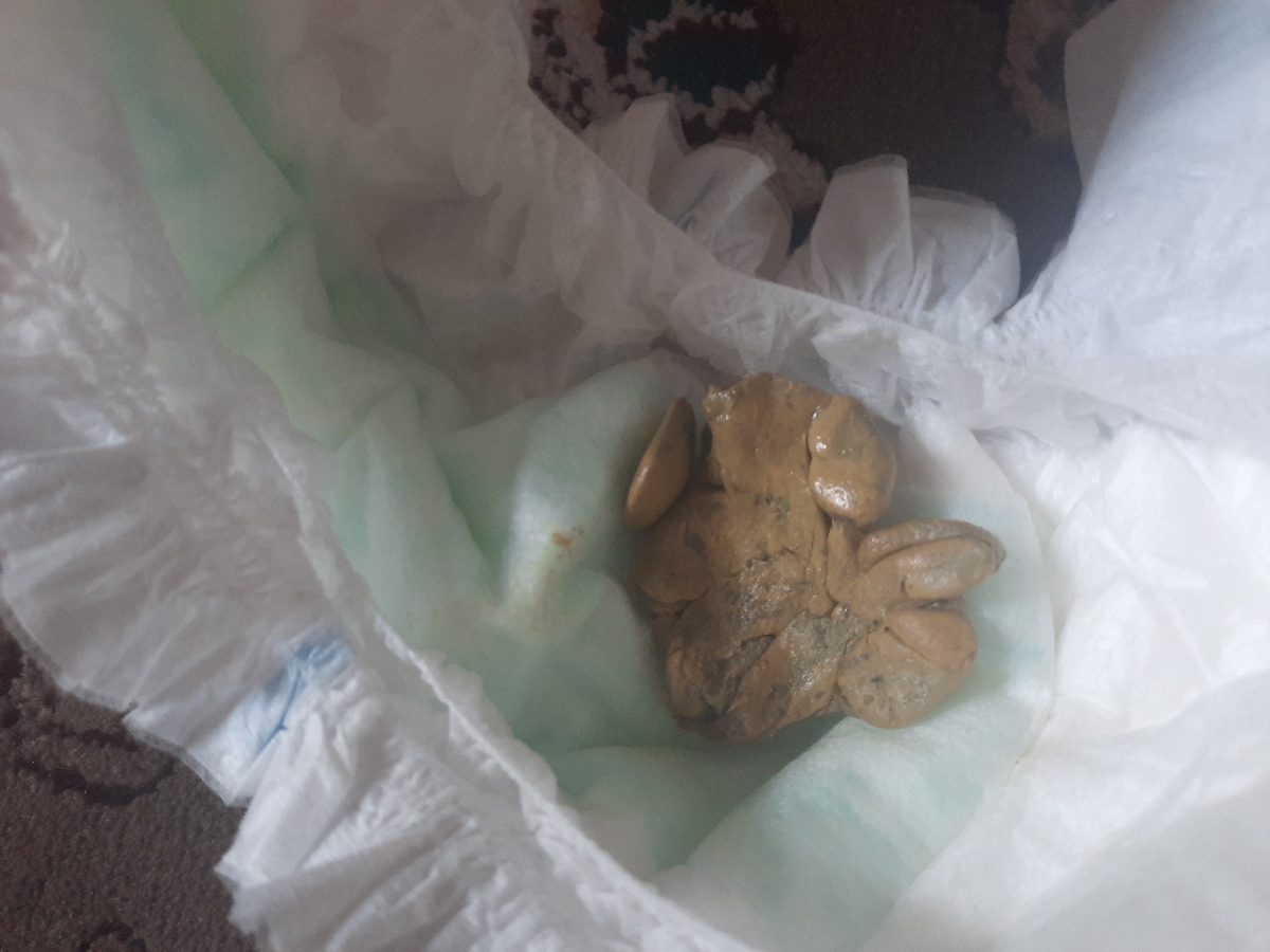 عذر میخوام اینم عکس دفعش هست هر روز هم دفع داره ولی این شکلی