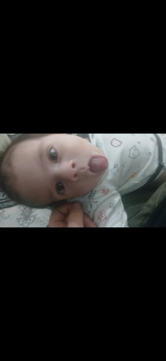 تب نوزاد سفتی شکم دکتر اوما جان ممنون میشم جواب بدین تب نوزاد سفتی شکم دکتر اوما جان ممنون میشم جواب بدین