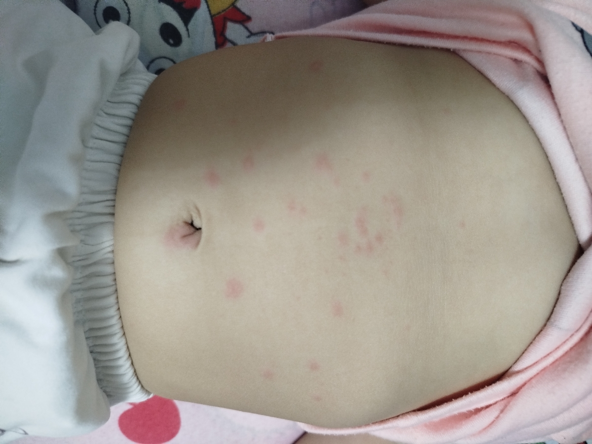 بیشتر رو شکم و بیکینیشه 
