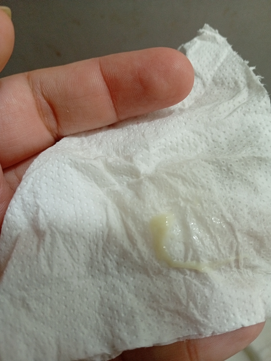 ببخشید دکتر ترشحم اینجوره