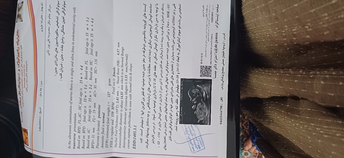 تفسیرجواب آزمایش آنومالی