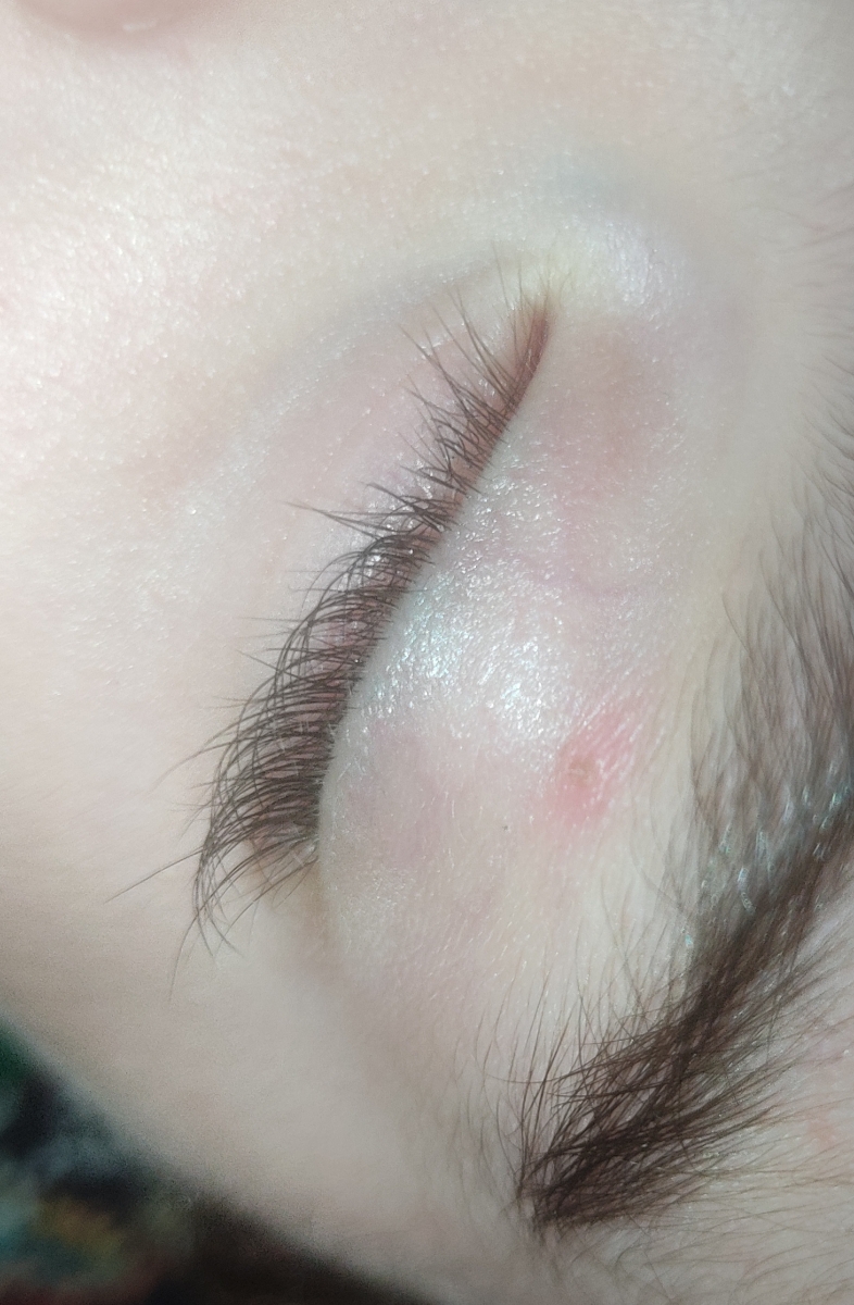 ❌ اورژانسی ❌آنفولانزای کودک موقع بهبودی جوش میزنع؟؟؟ ❌ اورژانسی ❌آنفولانزای کودک موقع بهبودی جوش میزنع؟؟؟