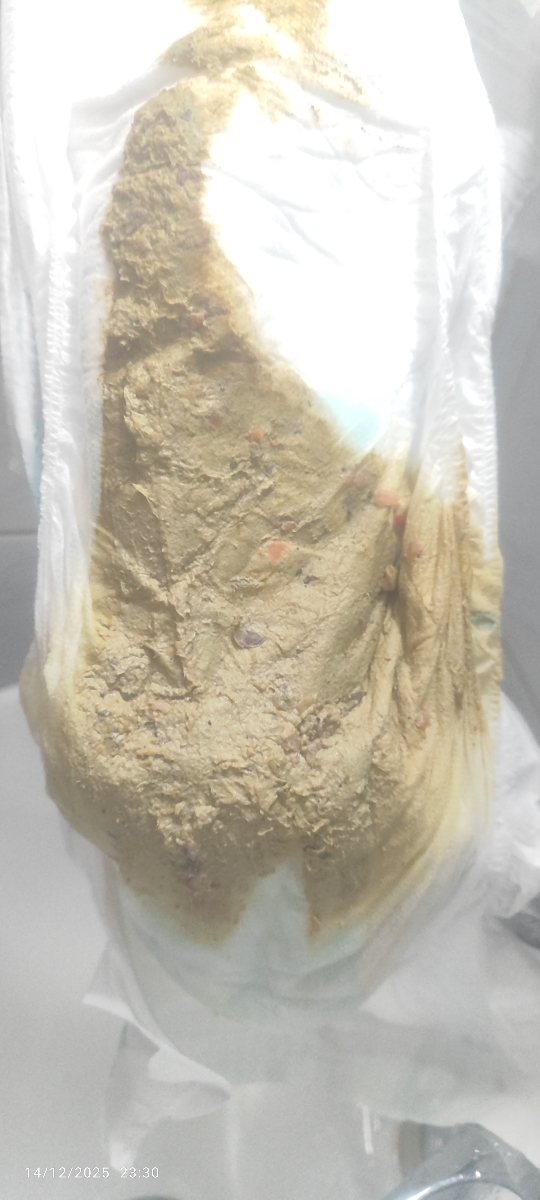 عکس مای بیبی🫣😓 رنگ غیر عادی مدفوع و تغییر شیرخشک عکس مای بیبی🫣😓 رنگ غیر عادی مدفوع و تغییر شیرخشک