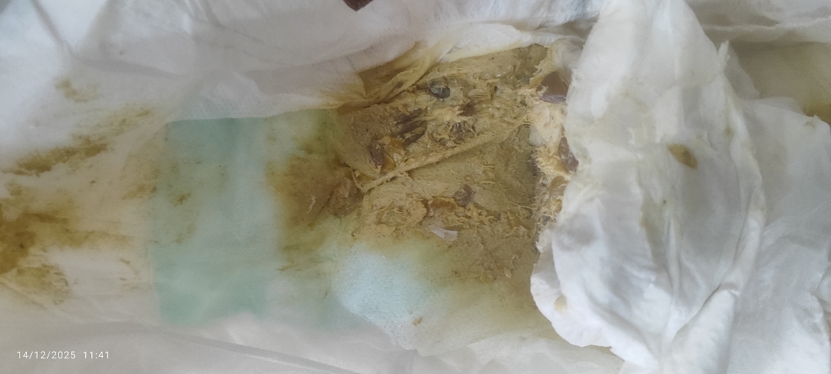 عکس مای بیبی🫣😓 رنگ غیر عادی مدفوع و تغییر شیرخشک عکس مای بیبی🫣😓 رنگ غیر عادی مدفوع و تغییر شیرخشک