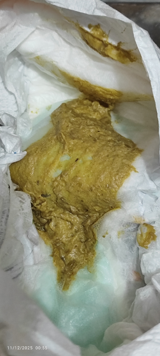 عکس مای بیبی🫣😓 رنگ غیر عادی مدفوع و تغییر شیرخشک عکس مای بیبی🫣😓 رنگ غیر عادی مدفوع و تغییر شیرخشک