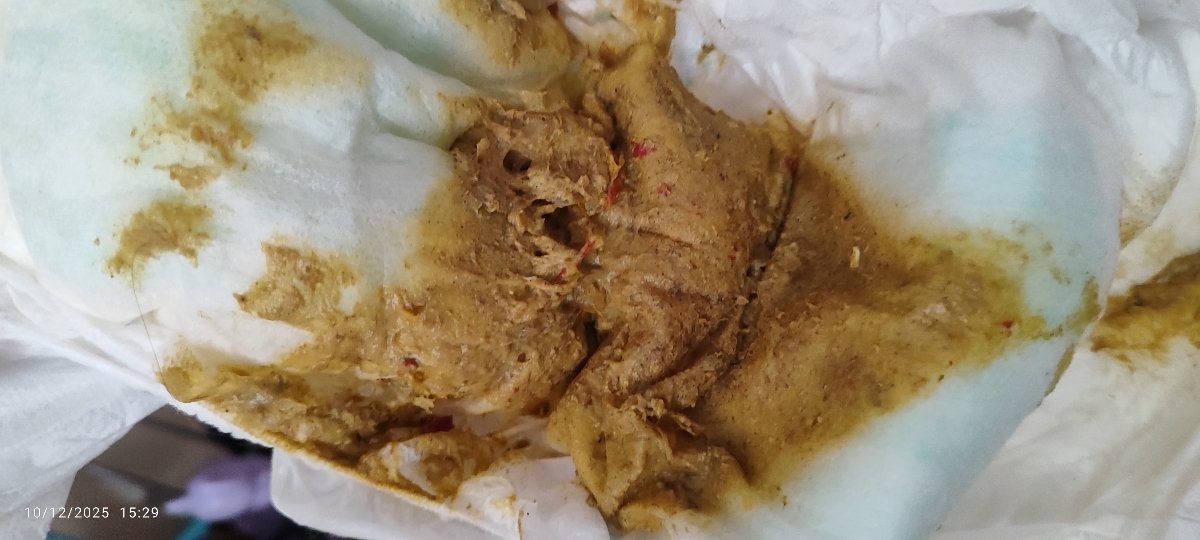 عکس مای بیبی🫣😓 رنگ غیر عادی مدفوع و تغییر شیرخشک عکس مای بیبی🫣😓 رنگ غیر عادی مدفوع و تغییر شیرخشک