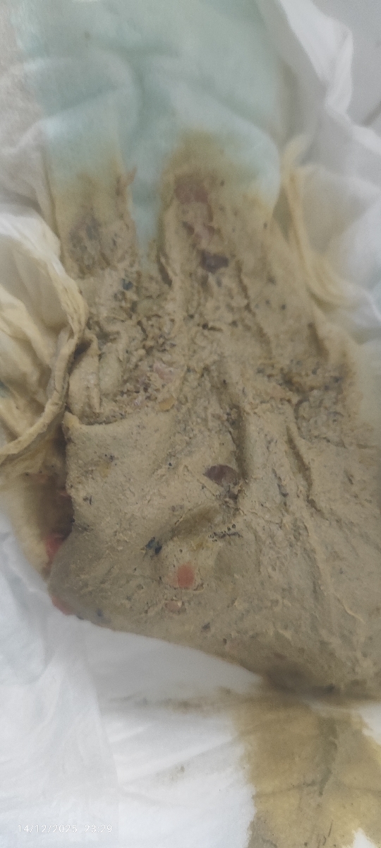 عکس مای بیبی🫣😓 رنگ غیر عادی مدفوع و تغییر شیرخشک عکس مای بیبی🫣😓 رنگ غیر عادی مدفوع و تغییر شیرخشک