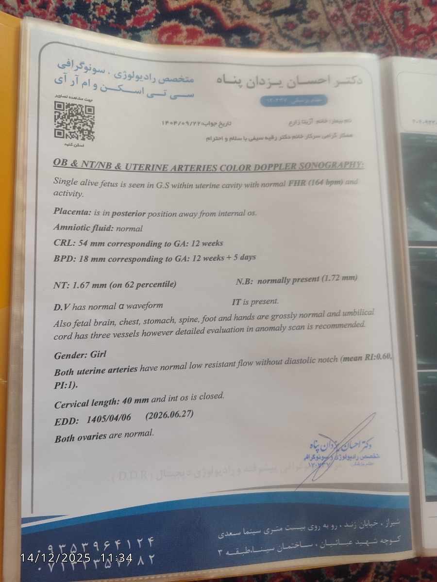 هفتع 12 دو روز ان تی رفتم BPDرو زده 18خطرناک نیست هفتع 12 دو روز ان تی رفتم BPDرو زده 18خطرناک نیست