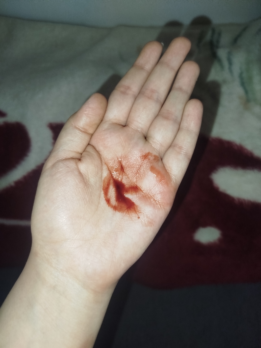 دکتر توروخدا زود جواب بدین دارم سکته میکنم دکتر توروخدا زود جواب بدین دارم سکته میکنم