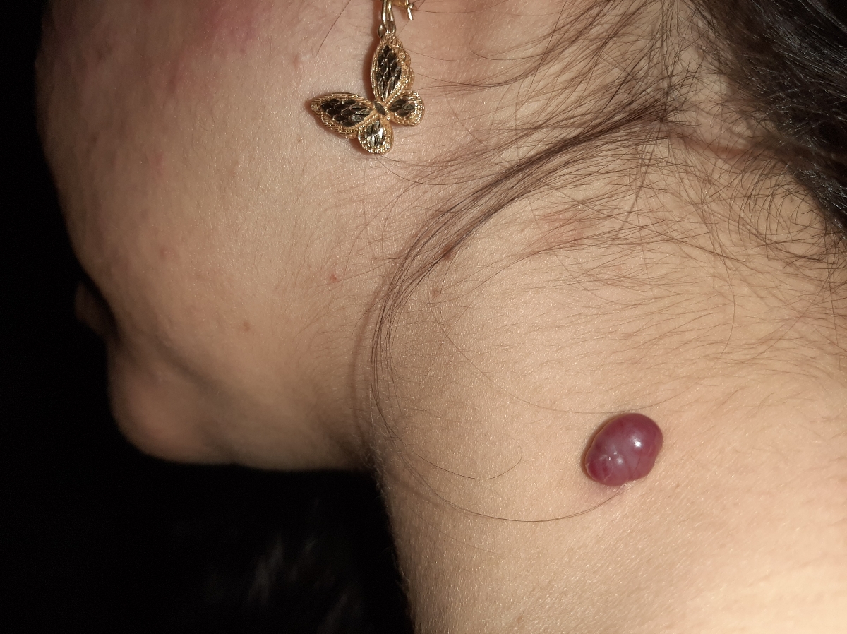 خانم دکتر میشه این عکسو ببینید چیه نگرانم