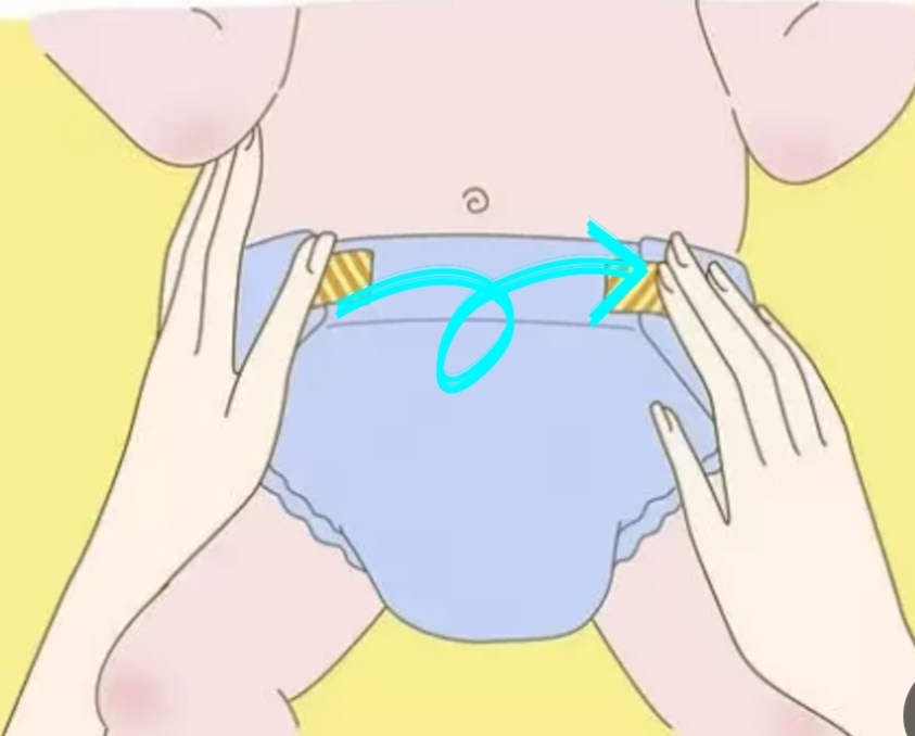 اورژانسی ❌️ تاول یا جوش روی پهلو کودک❌️ اورژانسی ❌️ تاول یا جوش روی پهلو کودک❌️