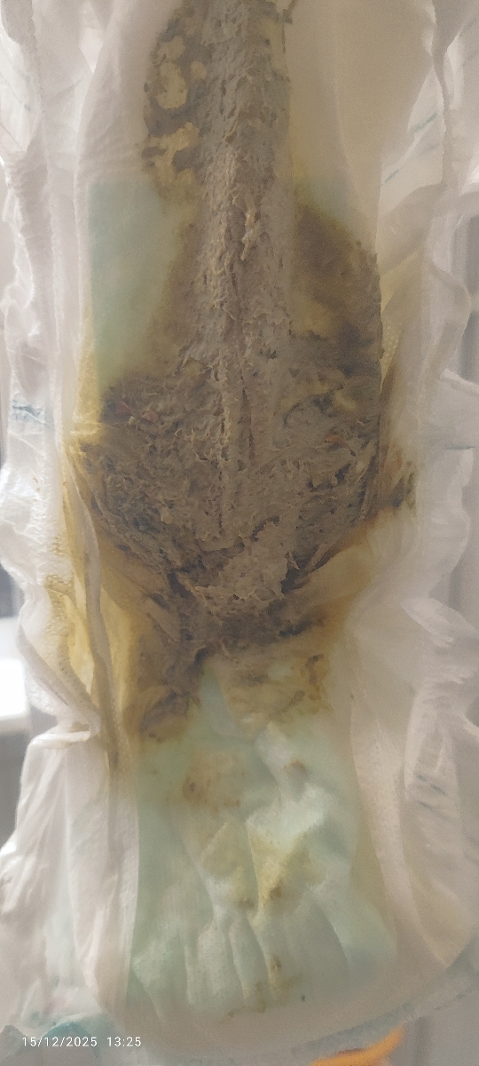 عکس مای بیبی🫣😓 رنگ غیر عادی مدفوع و تغییر شیرخشک عکس مای بیبی🫣😓 رنگ غیر عادی مدفوع و تغییر شیرخشک