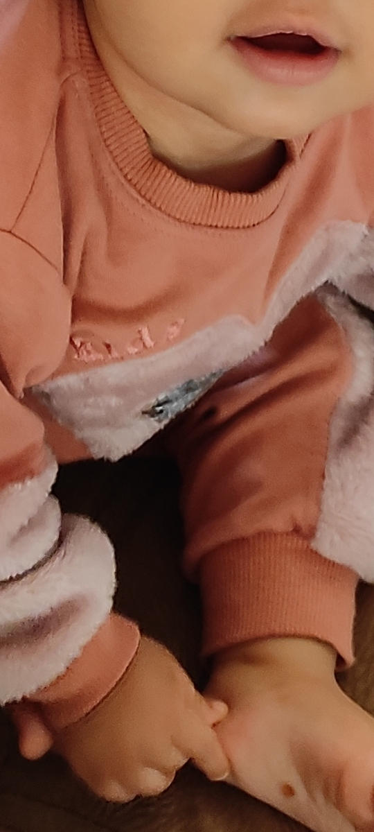 لکه سفید لکه گردن لکه سفید لکه گردن