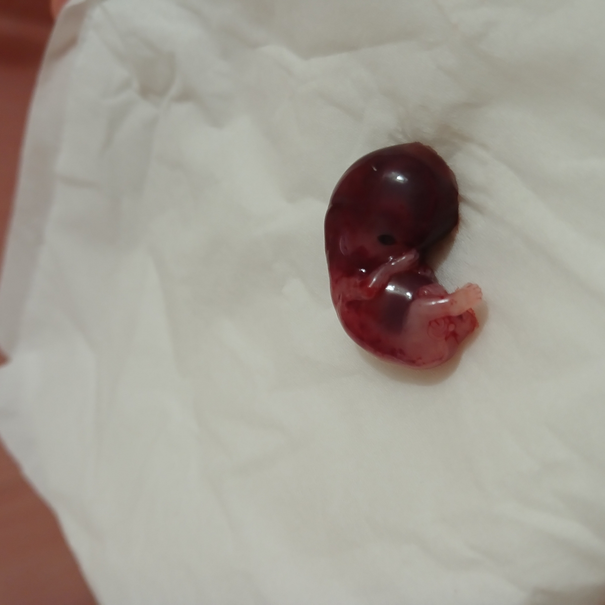 جنین سقط شده(+عکس)لطفا مامانای باردار و کسایی ک حالشون بد میشه تایپیک رو باز نکن