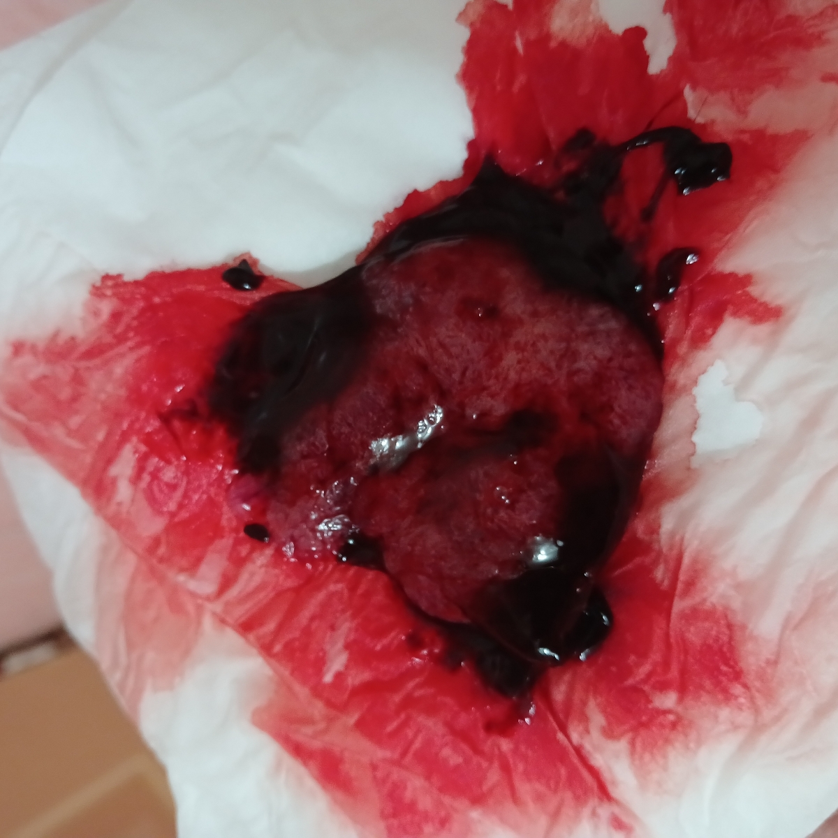 جنین سقط شده(+عکس)لطفا مامانای باردار و کسایی ک حالشون بد میشه تایپیک رو باز نکن