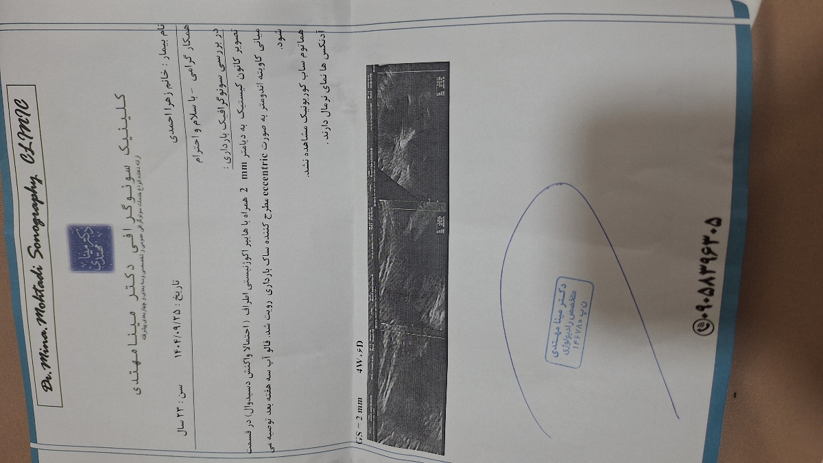 اینم برگه سونوم