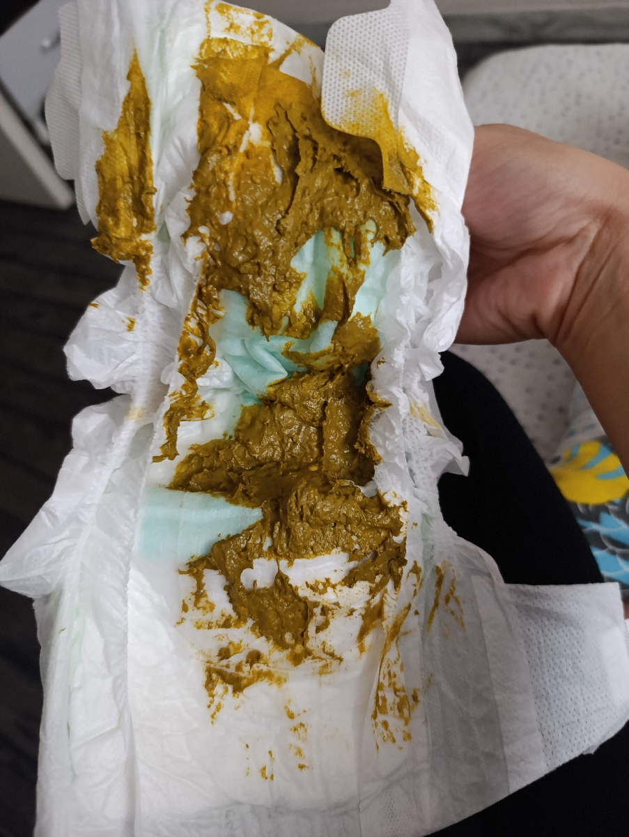 عذر میخوام بابت عکس عذر میخوام بابت عکس