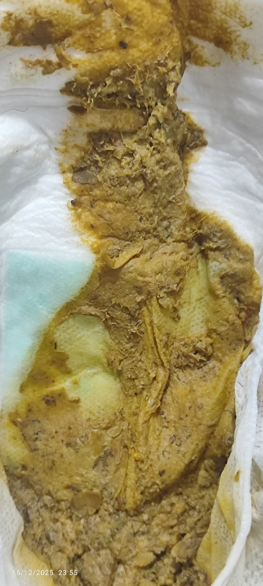 عکس مای بیبی🫣😓 رنگ غیر عادی مدفوع و تغییر شیرخشک