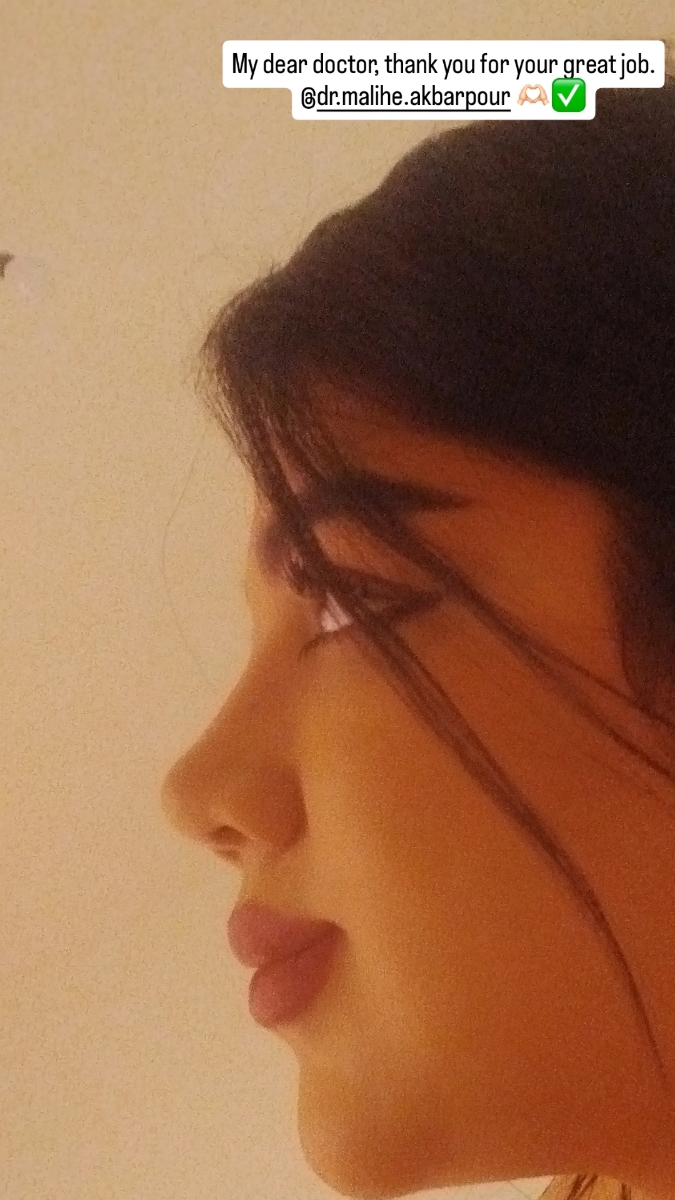 این برای دو هفته پیشه 