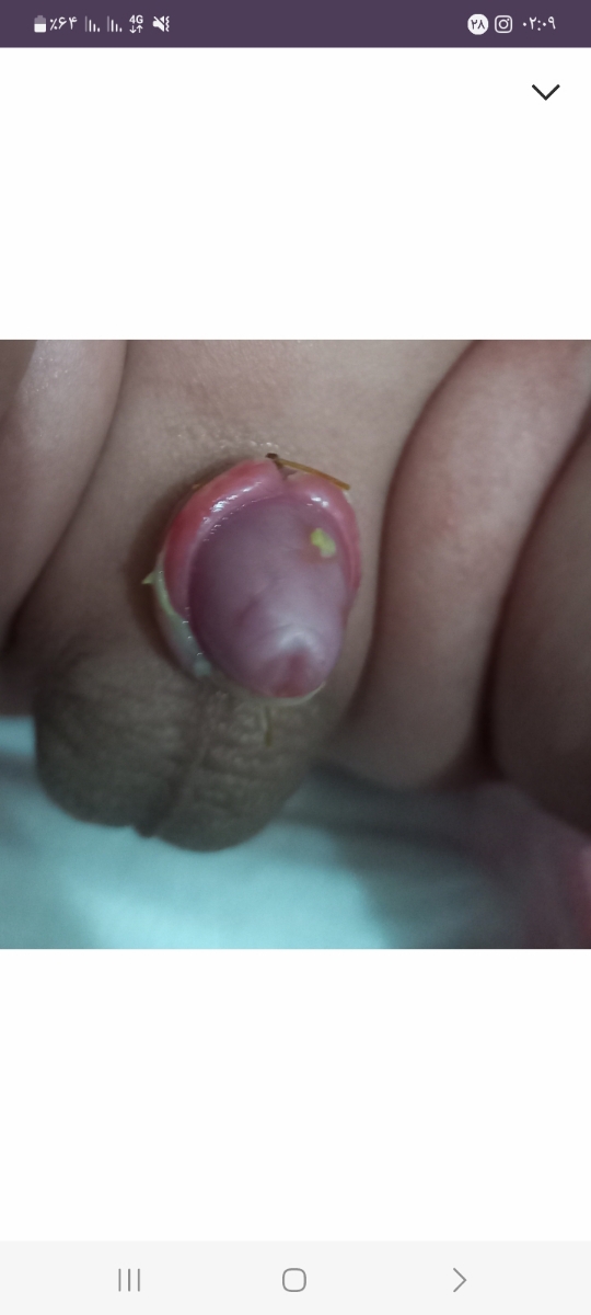 این عکسو تازه دیدم ۲ماهش بود ختنش کردم اینجا بیضه ها عادین