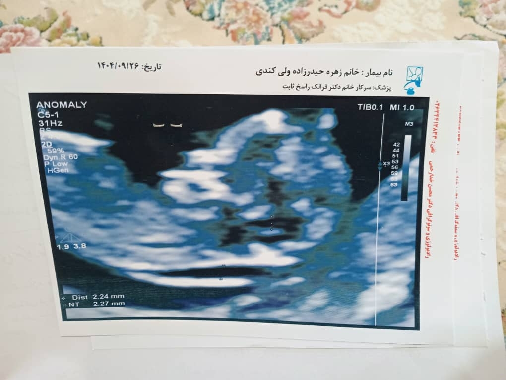 دخترا بیاید نظر بدید بچه دختره یا پسره؟