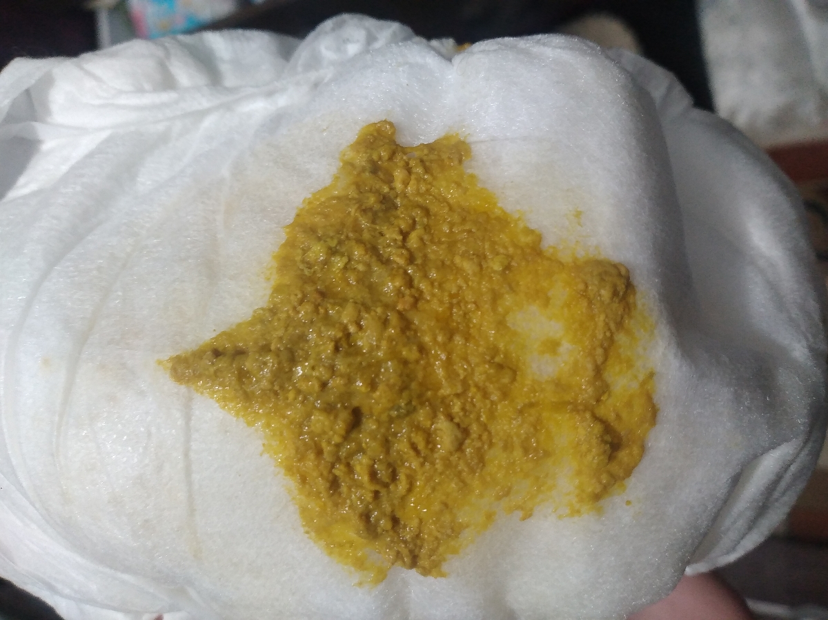 از دیروز بهش شیر ال اف دارو دکتر دادم‌اینجوری شده