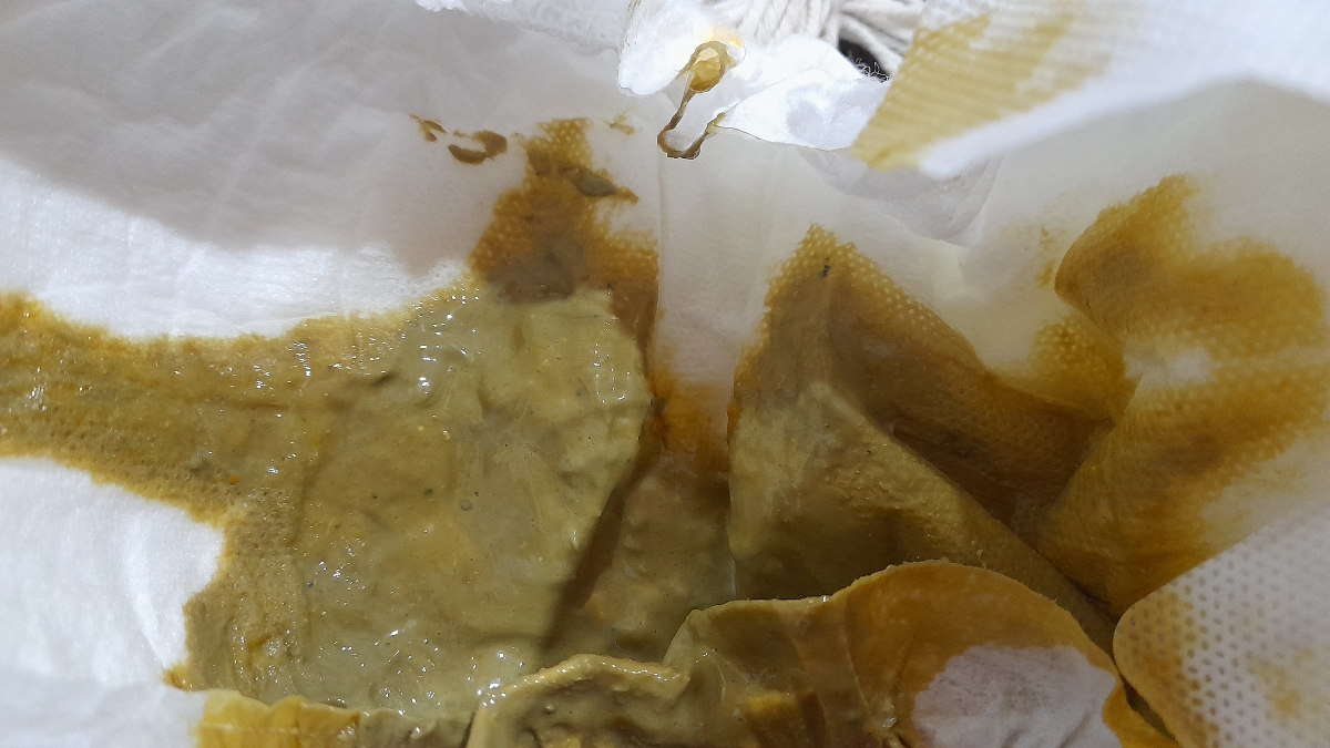 علت مدفوع آبکی نوزاد چیست