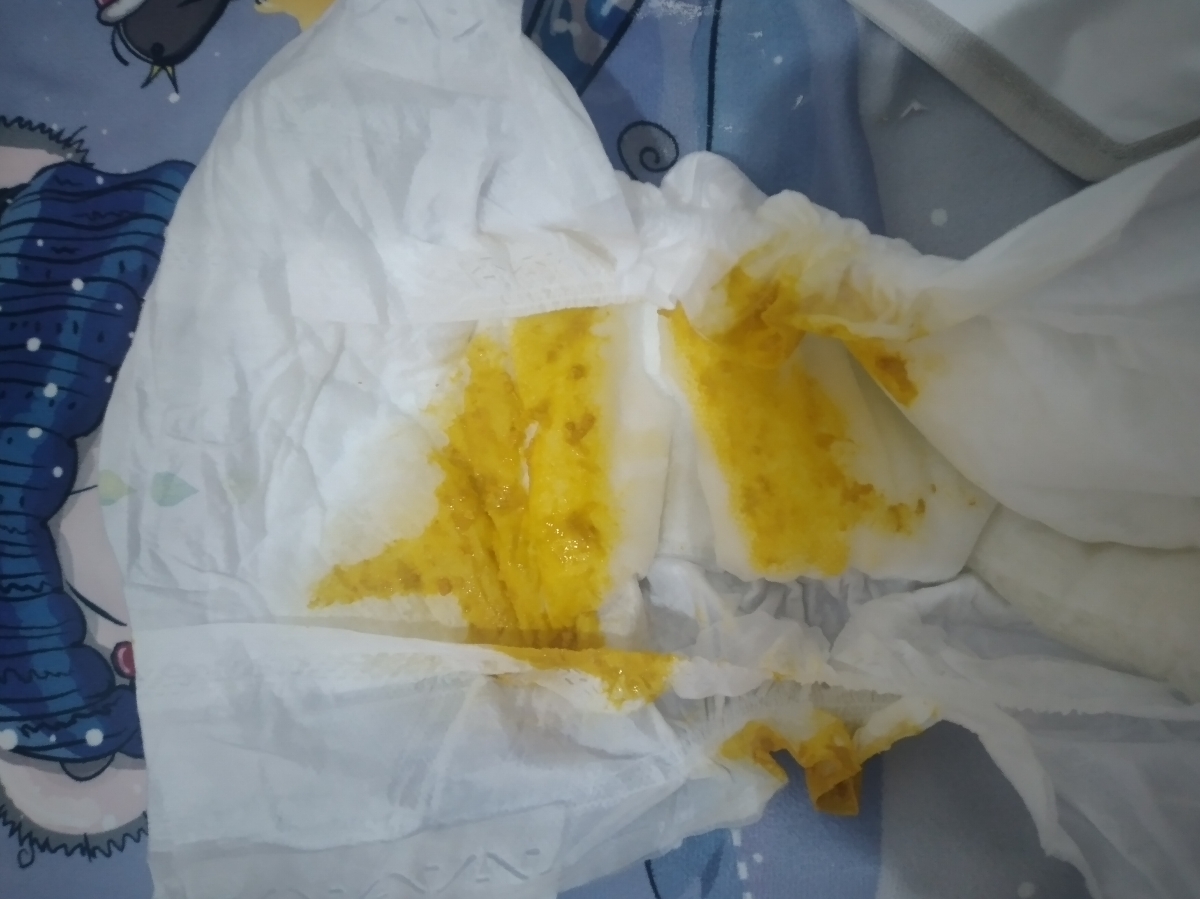 الان اینجور شده از صبح تا الان دوبار دفع داشته اینجوری بوده از از شنبه ظهرش دیگه بهش شیر خسک‌ندادم شیدخودمو دادم فقط جمعه ظهر تا شنبه ظهر شیر ال اف دادم 
الان باز اینجوری شده اسهال مجدد شیر خشک ال اف بدم 