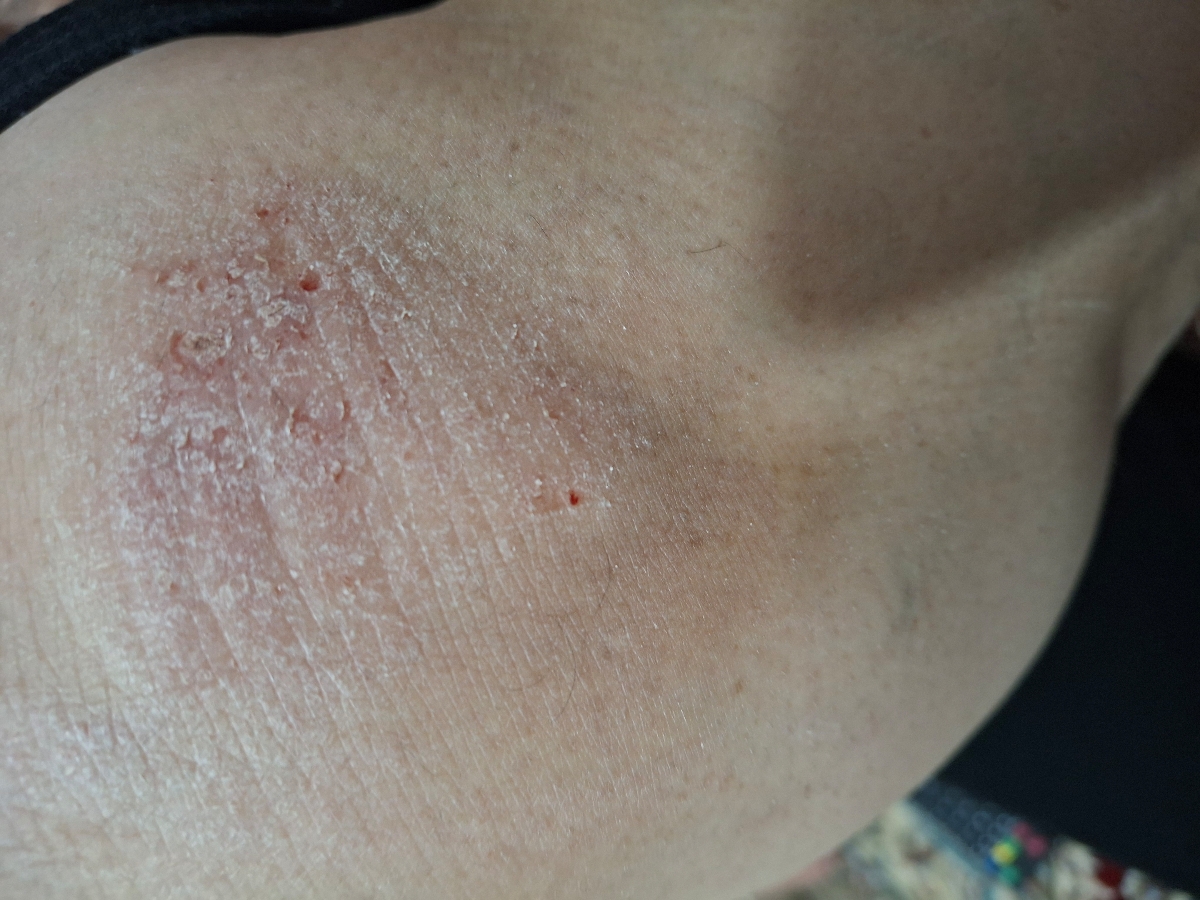 زانوی مادرم خارش داره واذیت میکنه