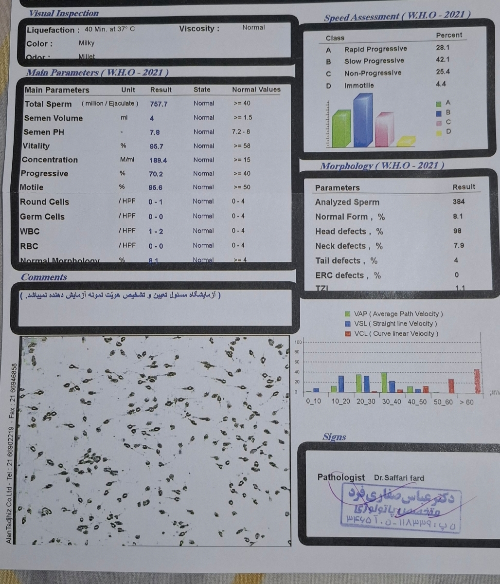 تفسیر آزمایش اسپرم همسرم