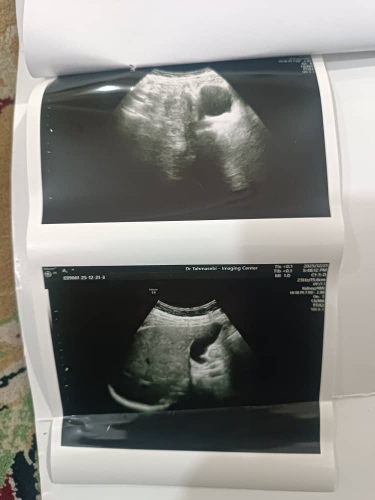 سونو شکم و لگن سونو شکم و لگن