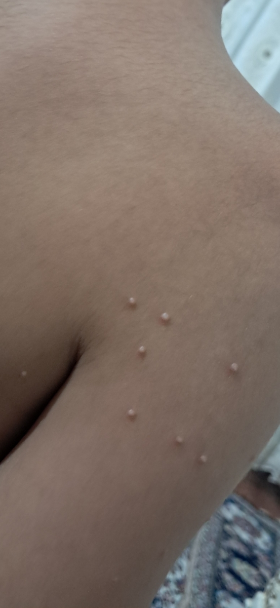 بدن پسرم مثل جوش زده بیرون اما جوش نیست