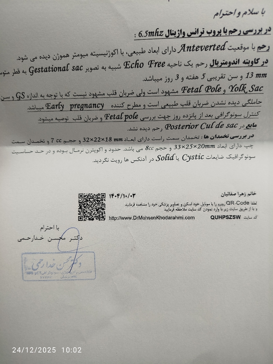 این سونوی امروزه