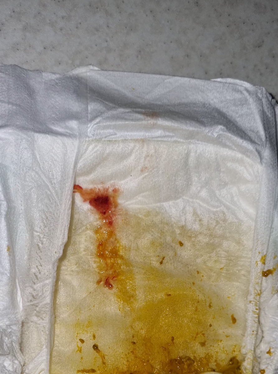 خون در مدفوع نوزاد