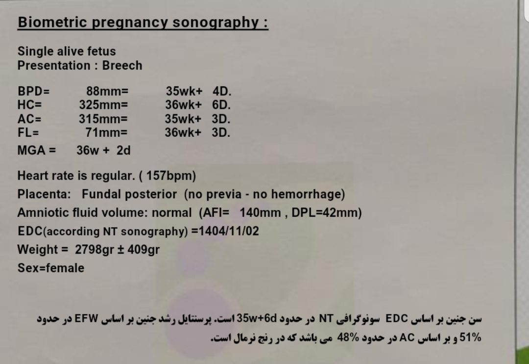 بررسی سونو ۳۶ هفته