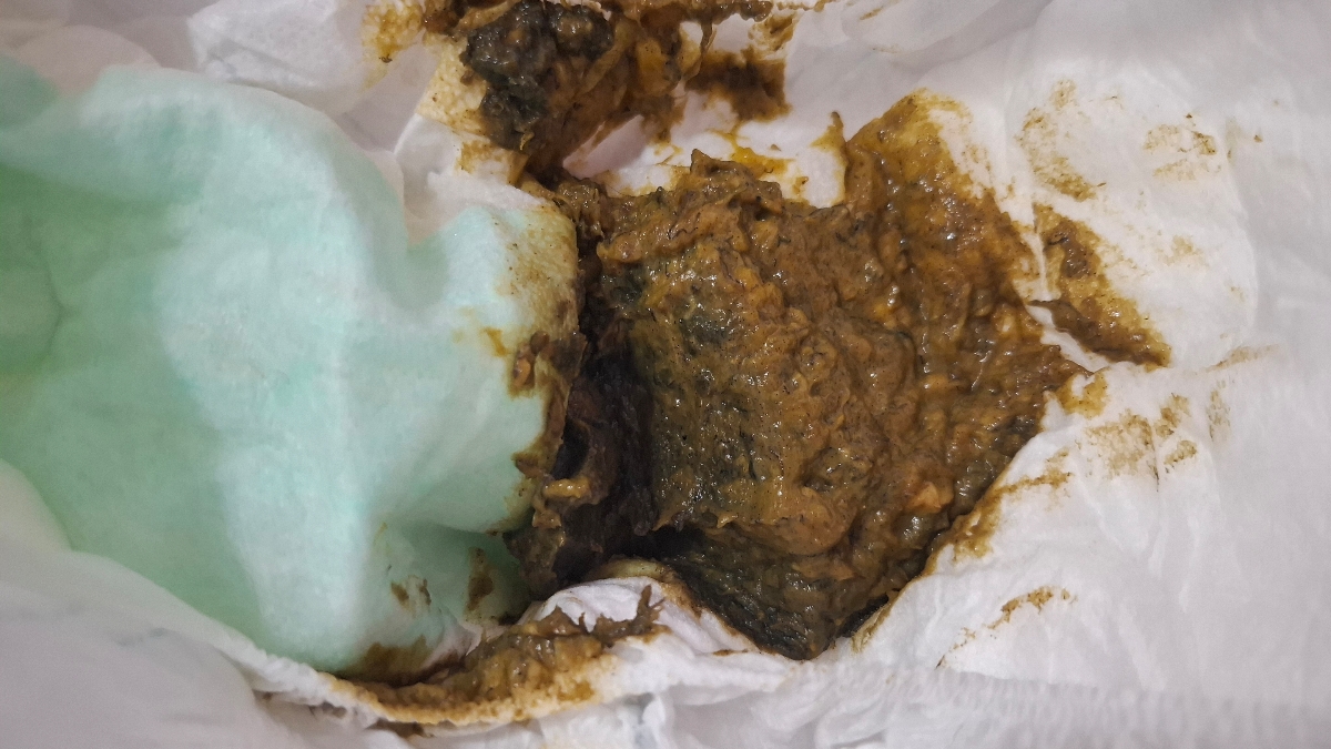 تست لبنیات و مدفوع کودک همراه عکس