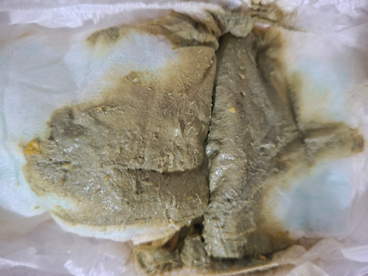 اپتامیل اچ ا و حساسیت