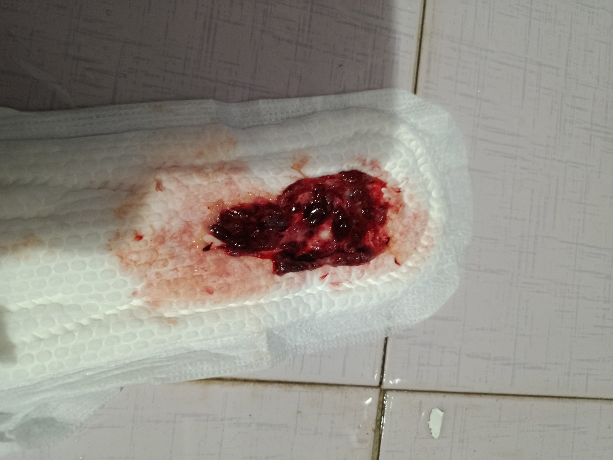 دفع لخته حاوی عکس لطفاً اگه بدتان میاد باز نکنید