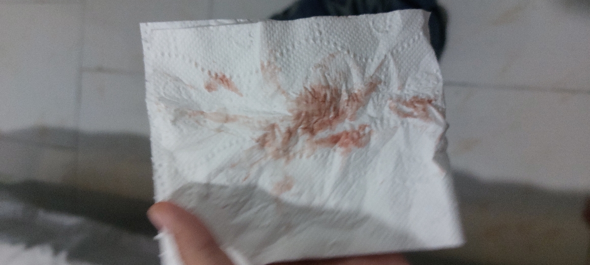 لکه بینی هفته چهارم