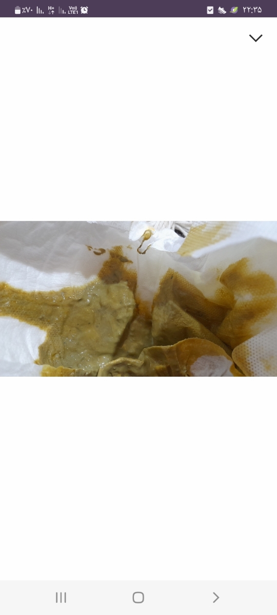 دلیل مدفوع ابکی نوزاد