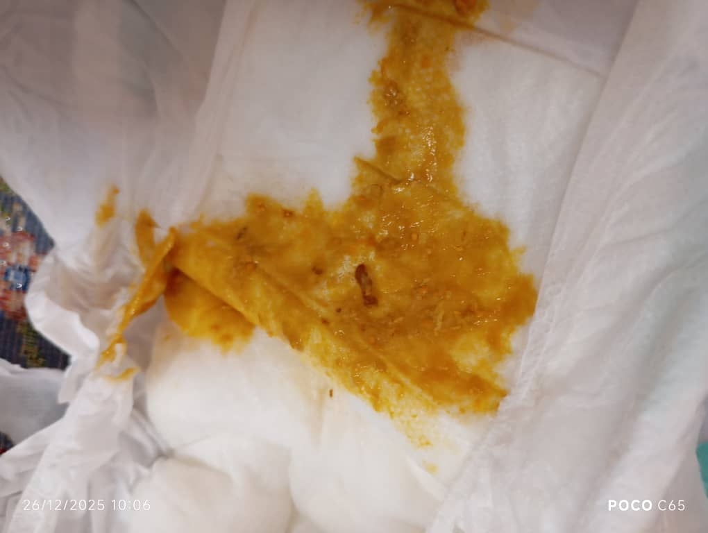 از بچه منم اینجوریه الان این خلطی