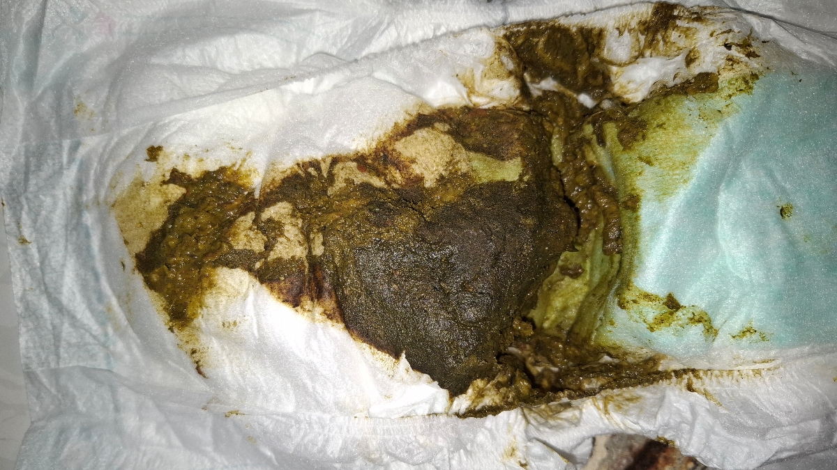 خانم دکتر این دفع امروزشه 
از نظر من که خلطی نیست 
شما هم لطفا نظرتون رو بگین 