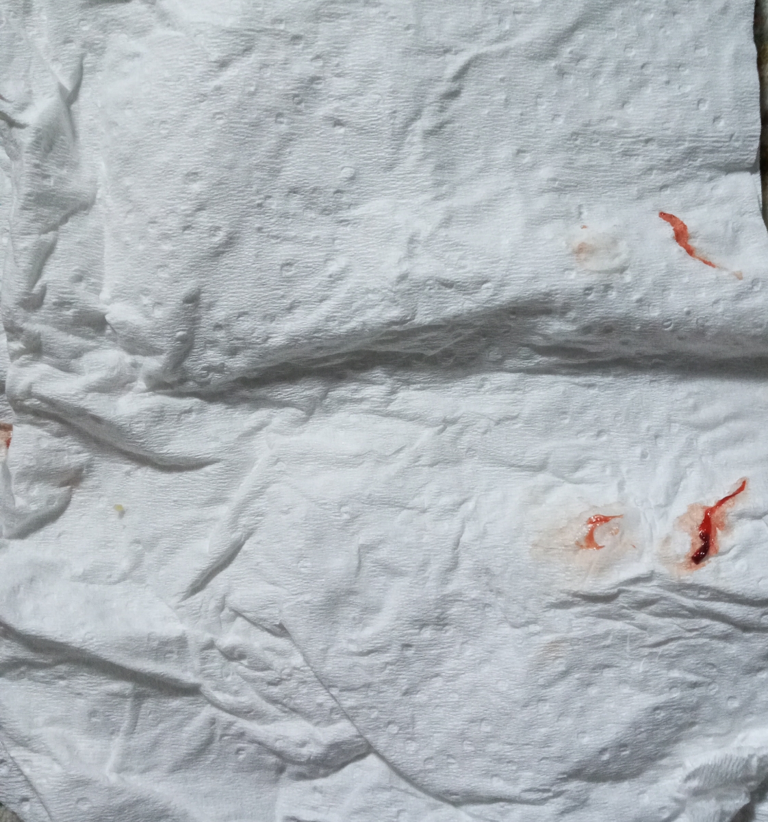 عکس رگه خونی فرستادم