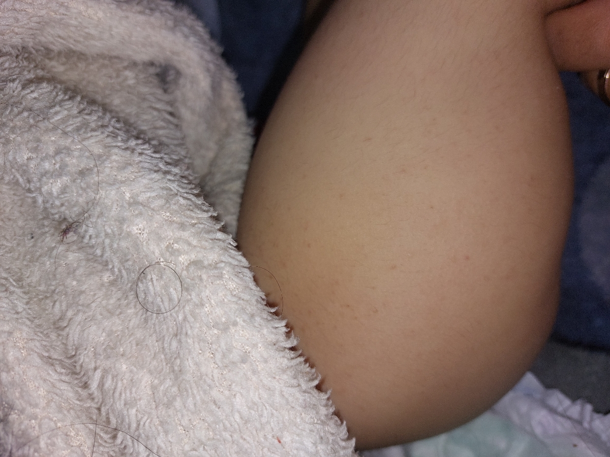 علت دونه های خیلی ریز روی پای کودک