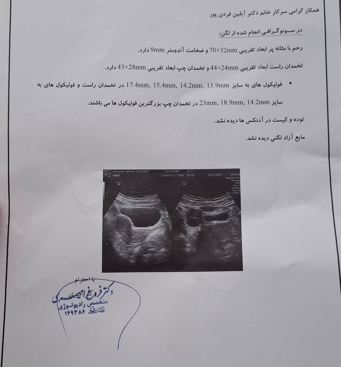 تفسیر سونوگرافی فولیکول روز ۱۲ پریودی