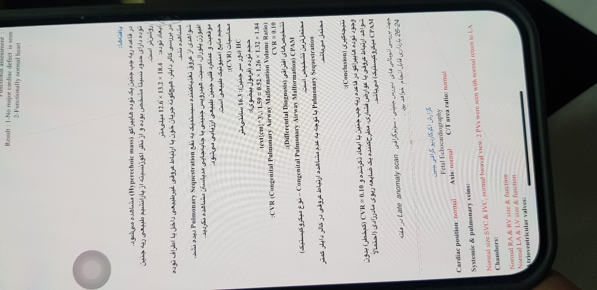 سونو آنومالی ...خانم دکتر لطفا جواب برین نگرانم ..کسی تجربه داره؟؟