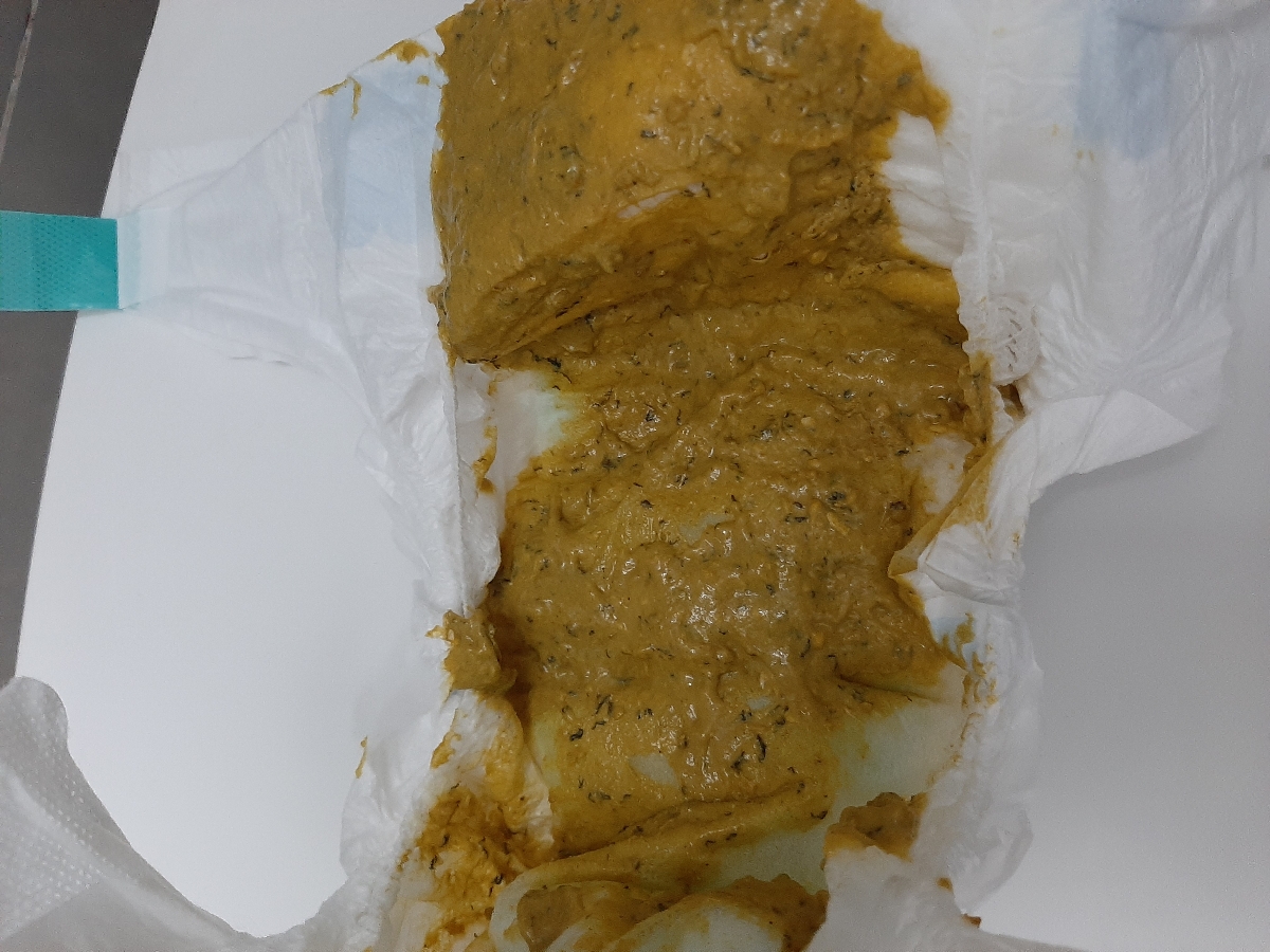 مدفوع نوزادم تغییر کرده