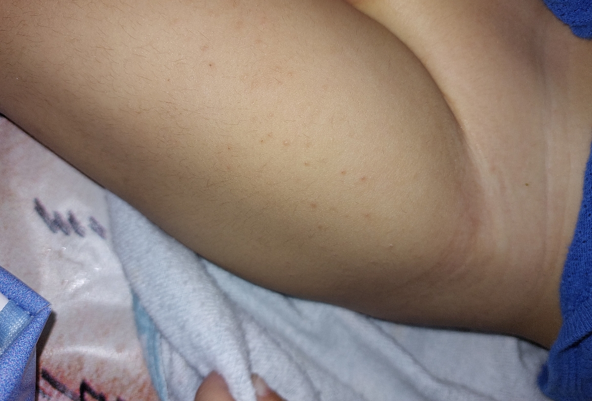 اینجوریه خانوم دکتر
اگزما هستش؟ اینجوریه خانوم دکتر
اگزما هستش؟