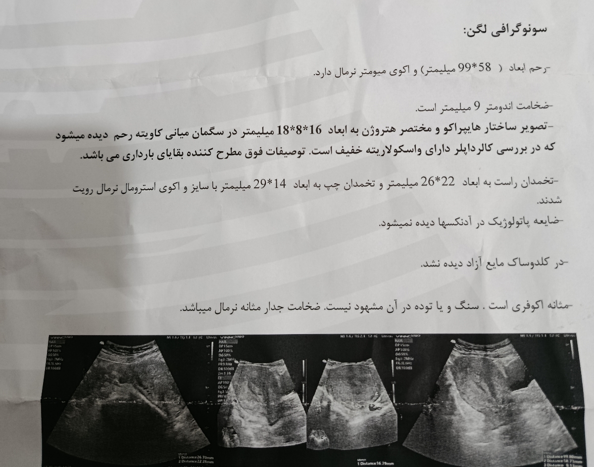 سونو گرافی(سقط+عکس لخته ) لطفاً اگر بدتان میاد باز نکنید